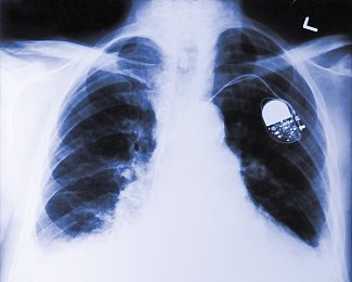 黄聊｜网络隐秘角落：揭秘黄聊历史，守护清朗网络-1