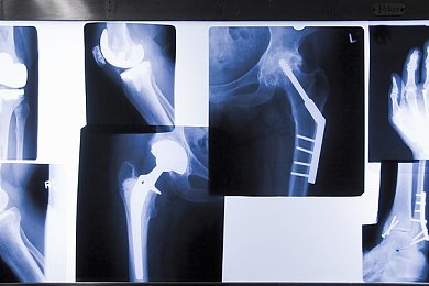 春雨直播免费视频｜春雨直播破冰付费壁垒，免费视频服务引爆行业新热潮