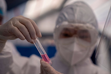 自由 管 凸轮 管西元｜自由与管制的机械辩证之旅-2